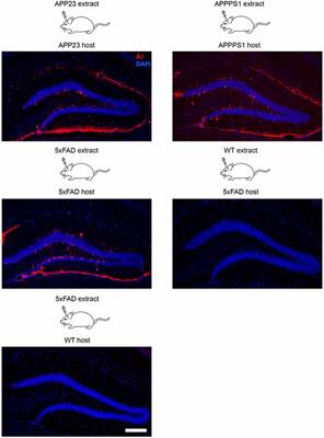 Aβ Seeding as a Tool to Study <mark class="highlighted">Cerebral Amyloidosis</mark> and Associated Pathology